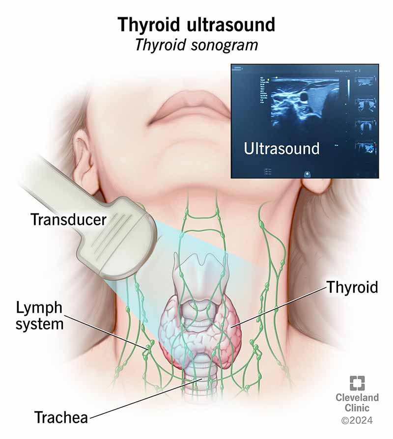 Ultrasounds1